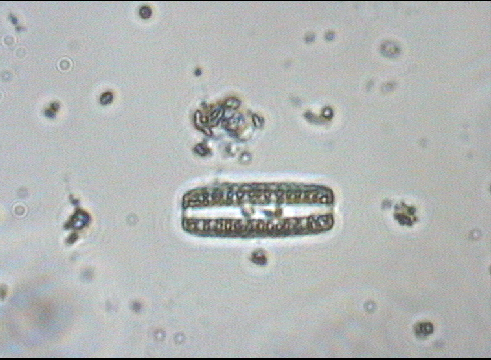 Dictyocha speculum